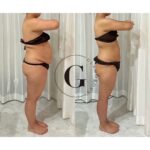 💎 GLAMOROUSダイエットについて≪新導入≫