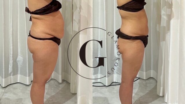 💎 GLAMOROUSダイエットについて≪新導入≫