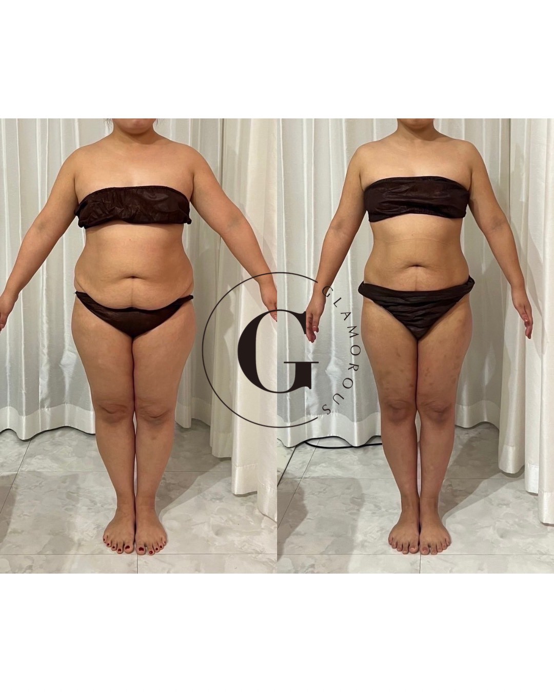 GLAMOROUSダイエット ビフォーアフター事例2